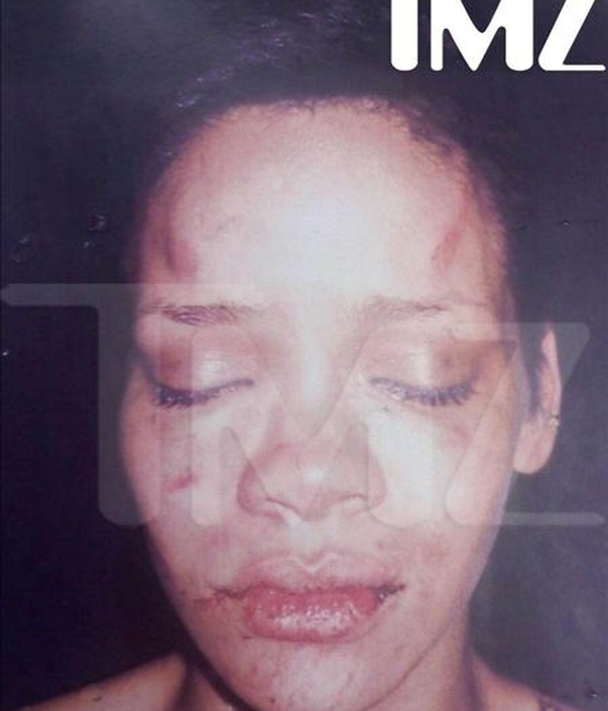 Fotografía cedida por TMZ en la que se observa a la cantante originaria de Barbados Rihanna con las secuelas de la agresión que sufrió por parte de su novio, el también cantante Chris Brown, antes de la ceremonia de entrega de los premios Grammy. EFE