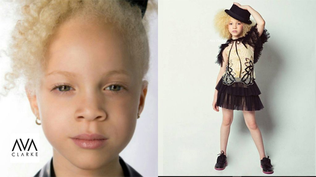 Su aspecto tan peculiar la ha llevado a triunfar en las redes sociales y en la moda