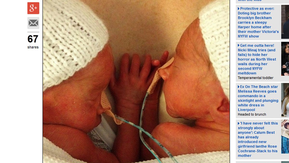 Dos gemelos prematuros se dan la mano tras reunirse después de una semana separados