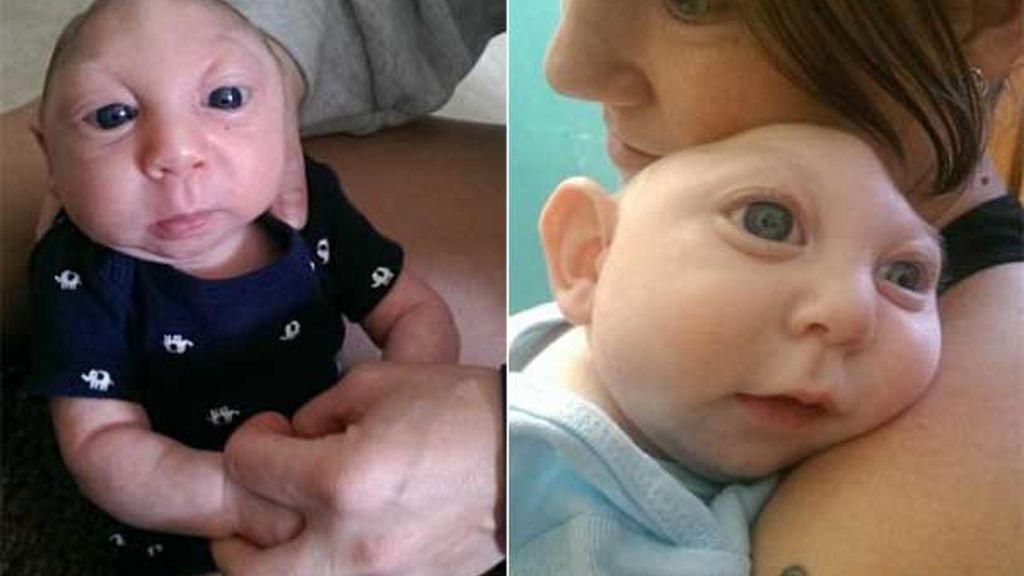 Jaxon Buell, el niño que sobrevive sin parte del cerebro y del cráneo