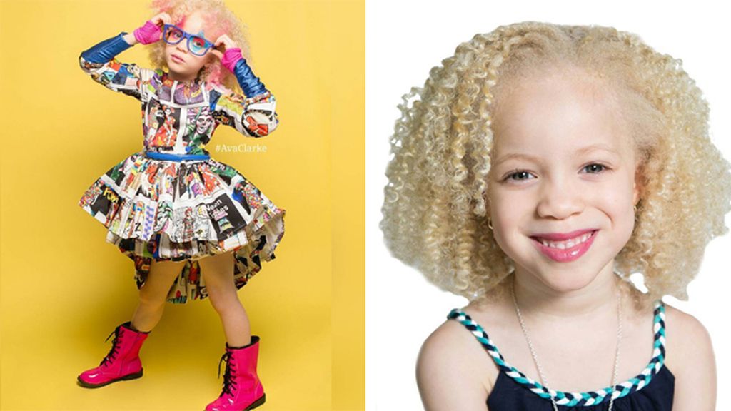 Ava Clark, la pequeña albina que triunfa en el mundo de la moda