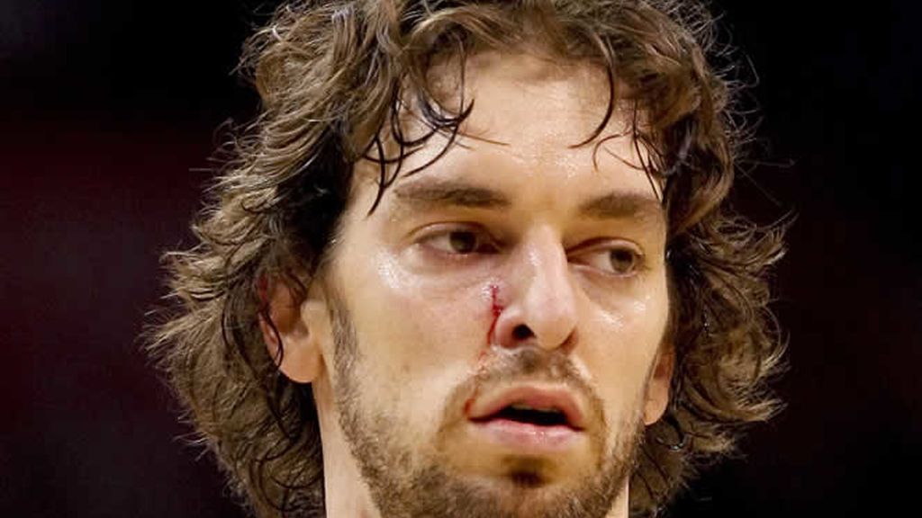 Gasol, herido tras una fuerte encontronazo Gasol, herido tras una fuerte encontronazo