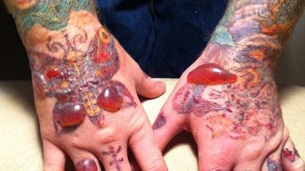 Cuando te tatúa un ‘chapucero’