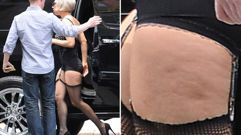 piernas