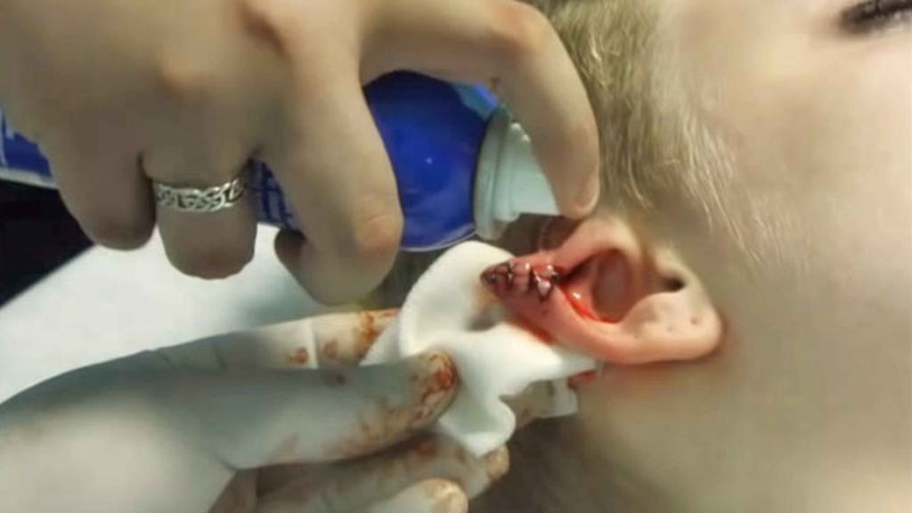 Se corta las orejas para parecer una Elfa