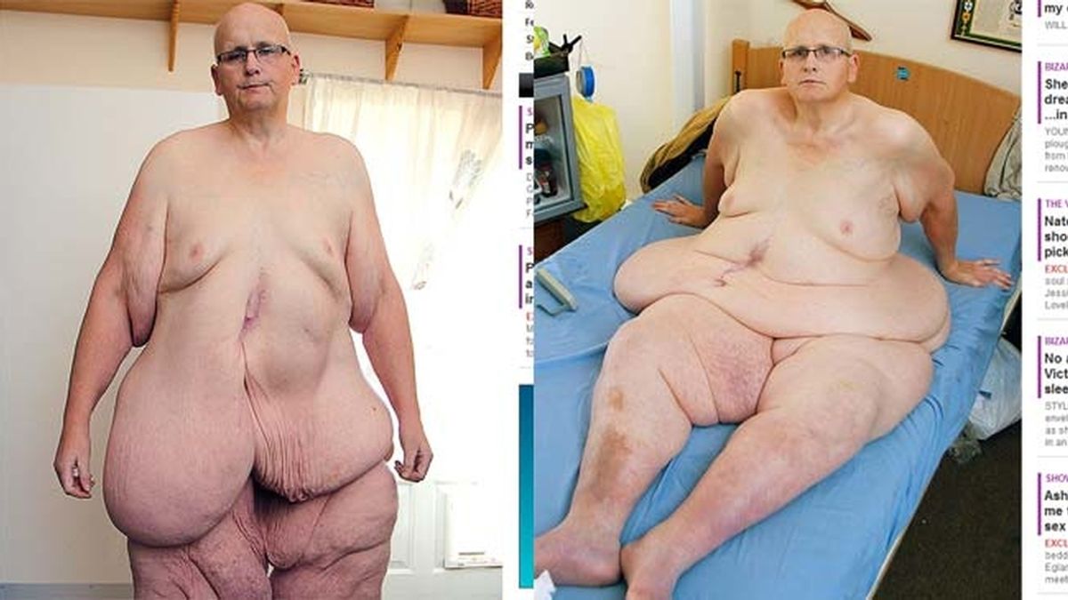 Paul Mason, el que fue el hombre más gordo del mundo