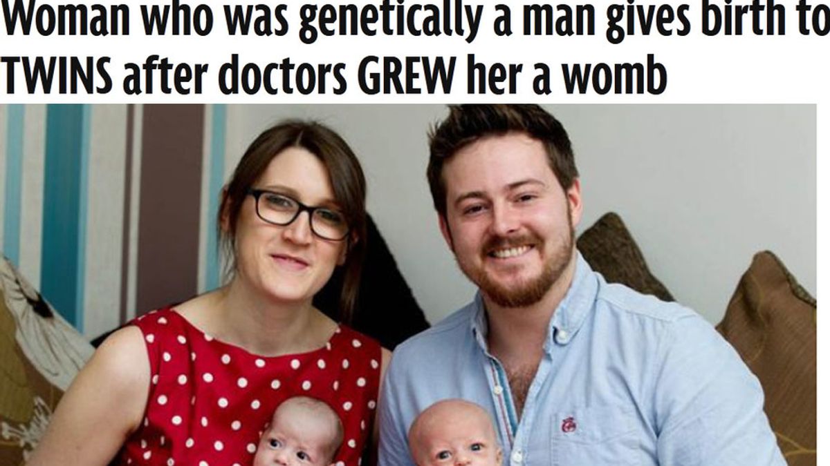 Con rasgos de mujer y genes de hombre, da a luz a gemelas