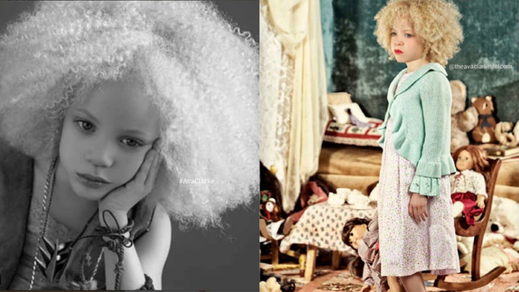 Hija de padres afroamericanos, nació con el pelo rubio y los ojos claros