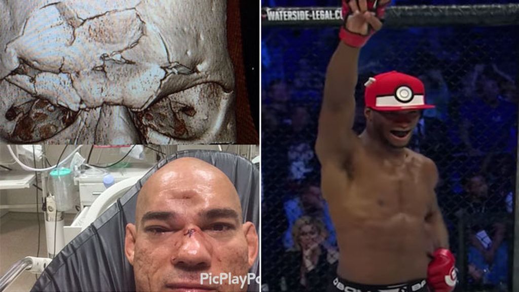 Pokémon Go,MMA