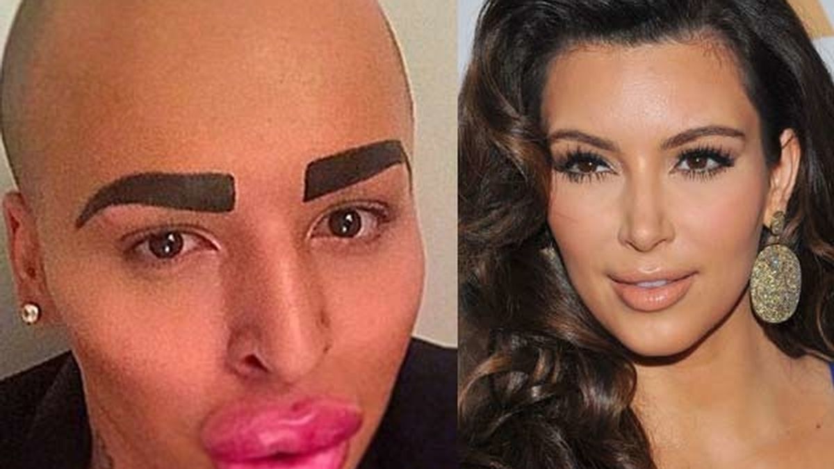 Se gasta 121.000 euros para parecerse a Kim Kardashian