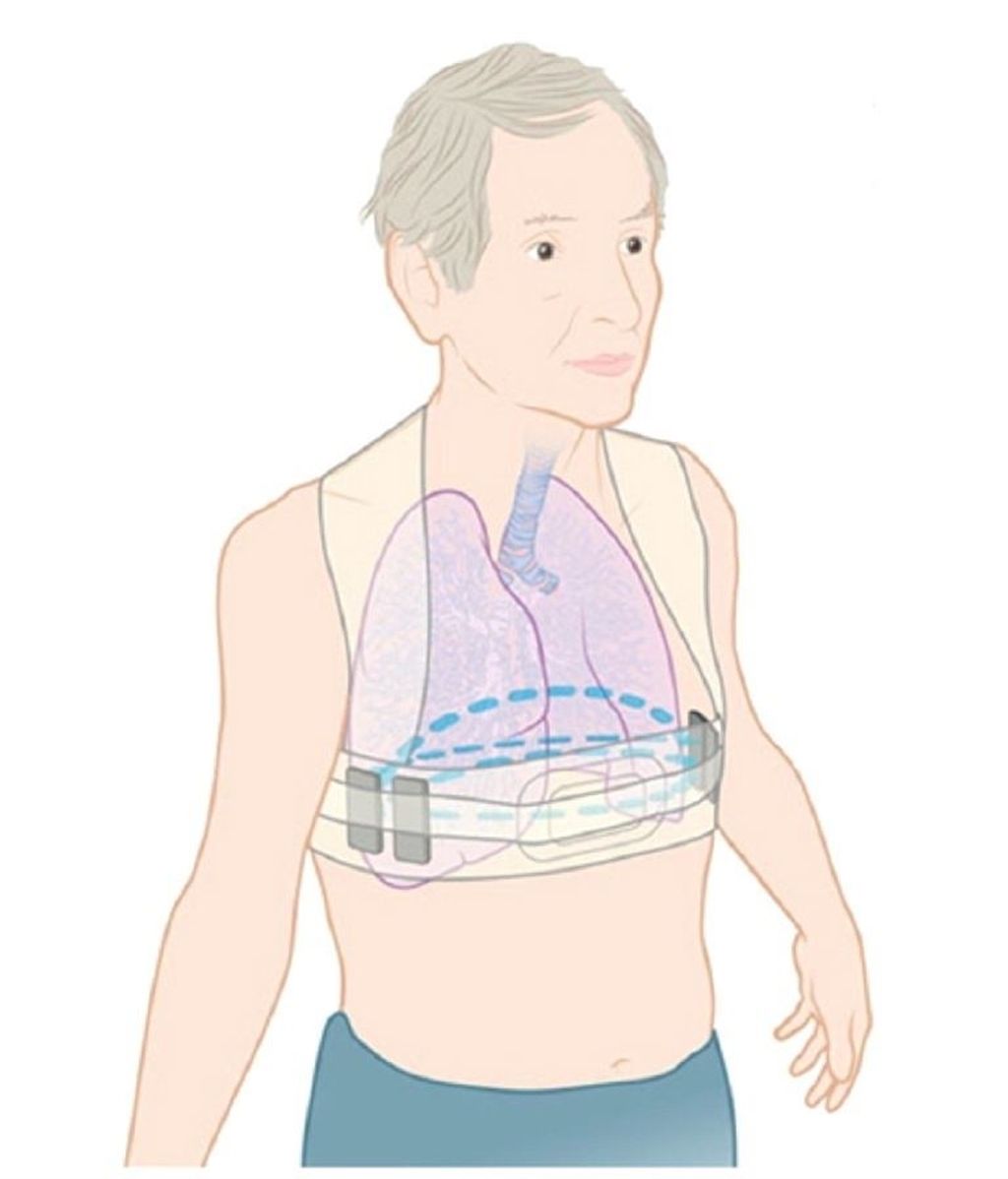 Un chaleco inteligente permite la monitorizar pacientes con insuficiencia cardiaca