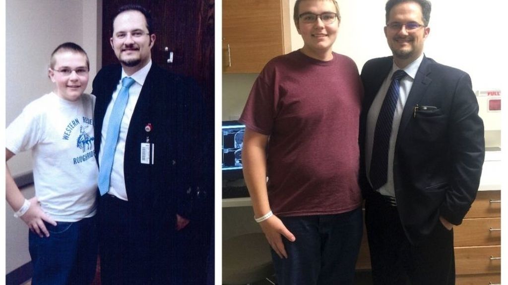 El antes y el después del chico que no crecía