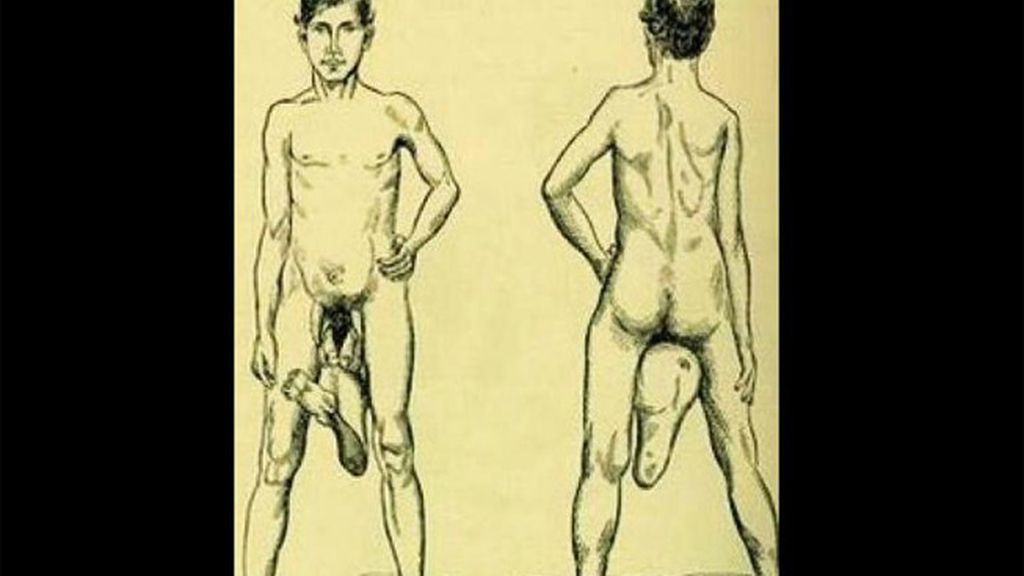 Juan Baptista Dos Santos, 'El hombre con dos penes'