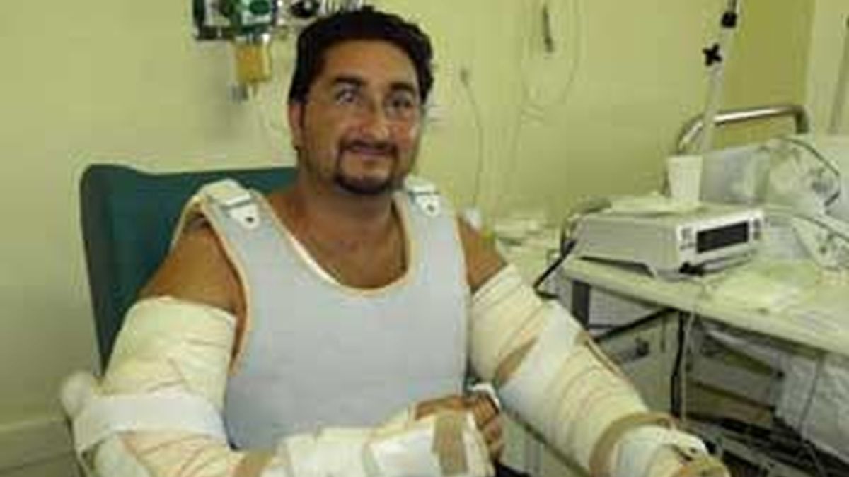 Imagen del paciente tras el transplante. Foto: Hospital Universitario La Fe