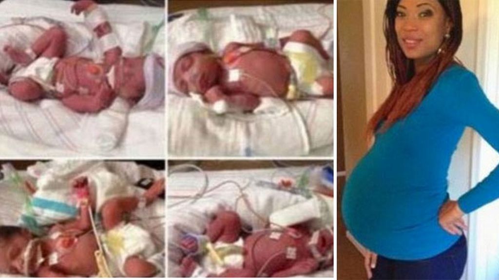 Muere tras dar a luz a cuatrillizos Muere tras dar a luz a cuatrillizos