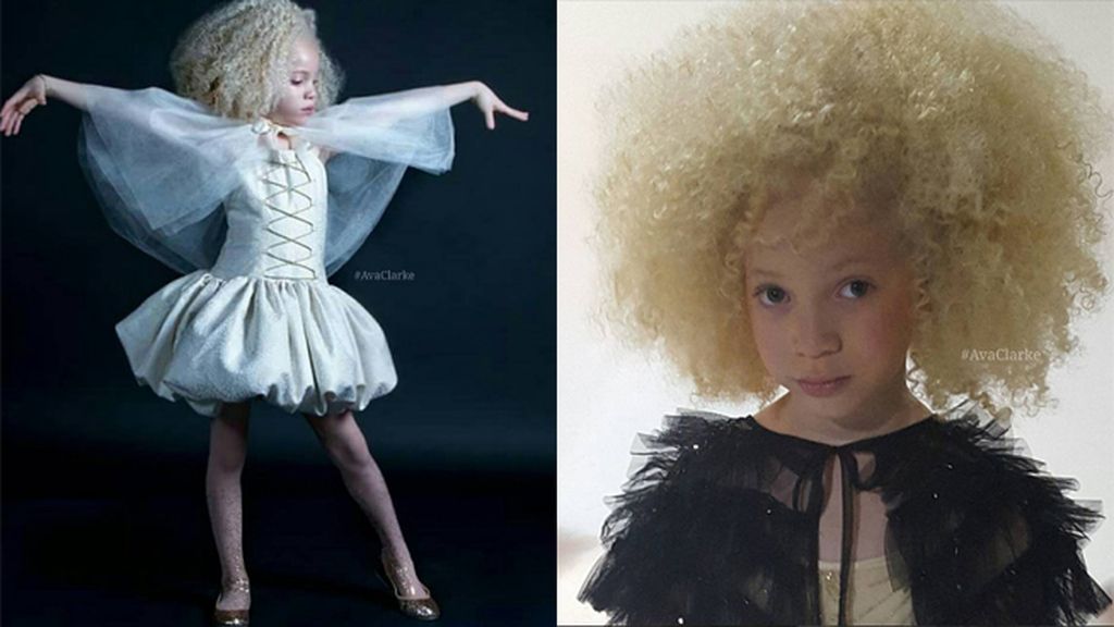Ava Clark, la pequeña albina que triunfa en el mundo de la moda