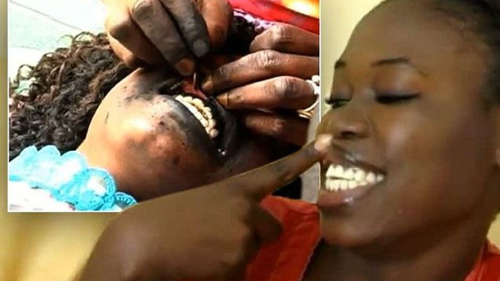 Las mujeres senegalesas se tatúan las encías de negro para 