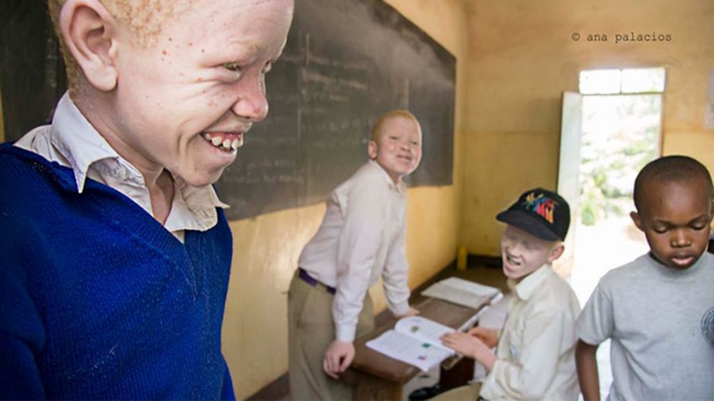 Albinos en Tanzania