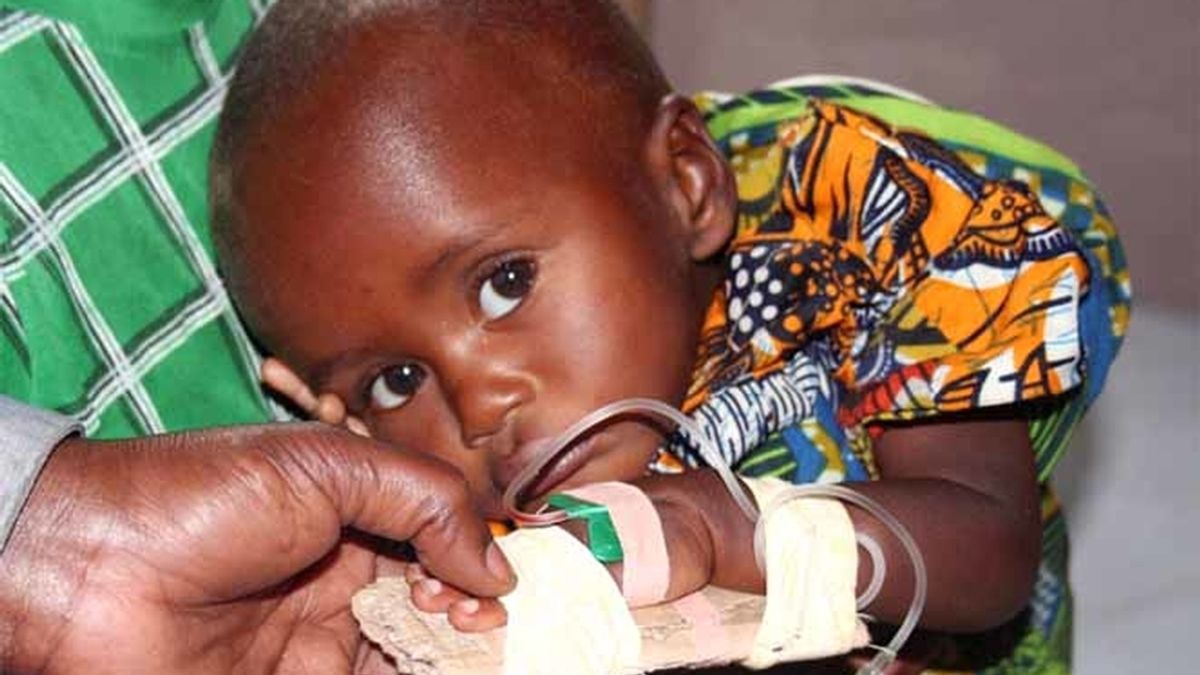 Un niño congolés enfermo de malaria