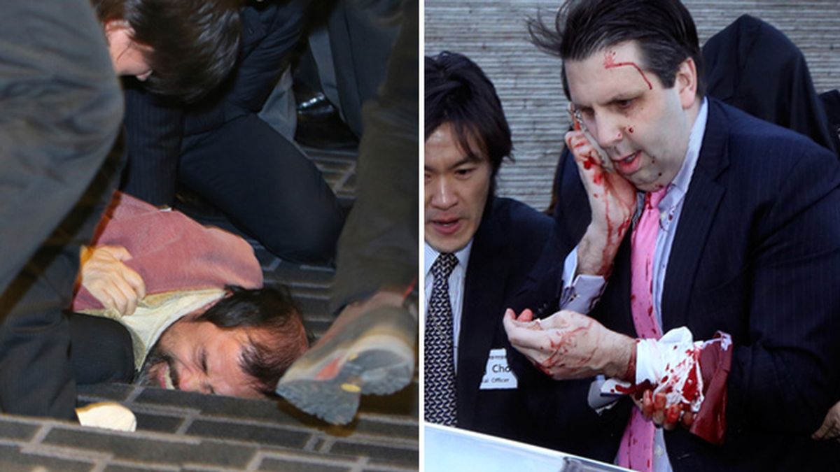 El embajador de EEUU en Corea del Sur atacado por un activista