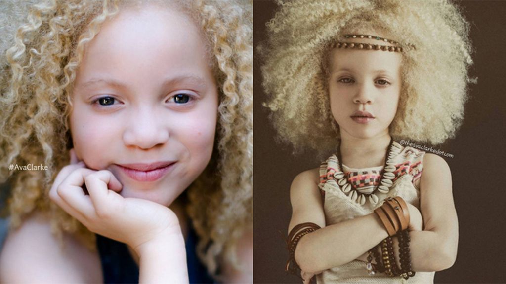Ava Clark, la pequeña albina que triunfa en el mundo de la moda