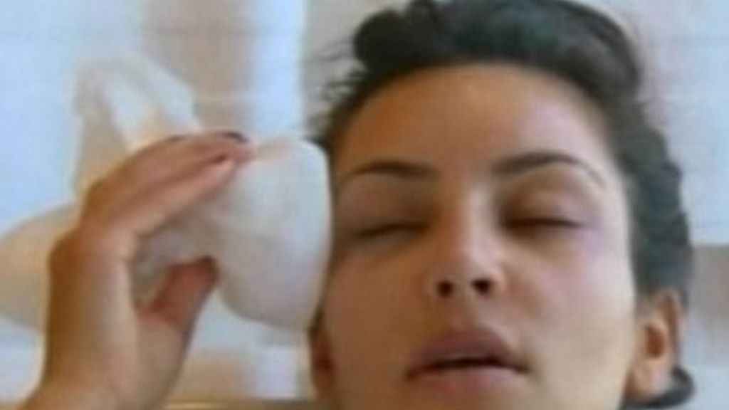 Kim Kardashian se pone botox en directo