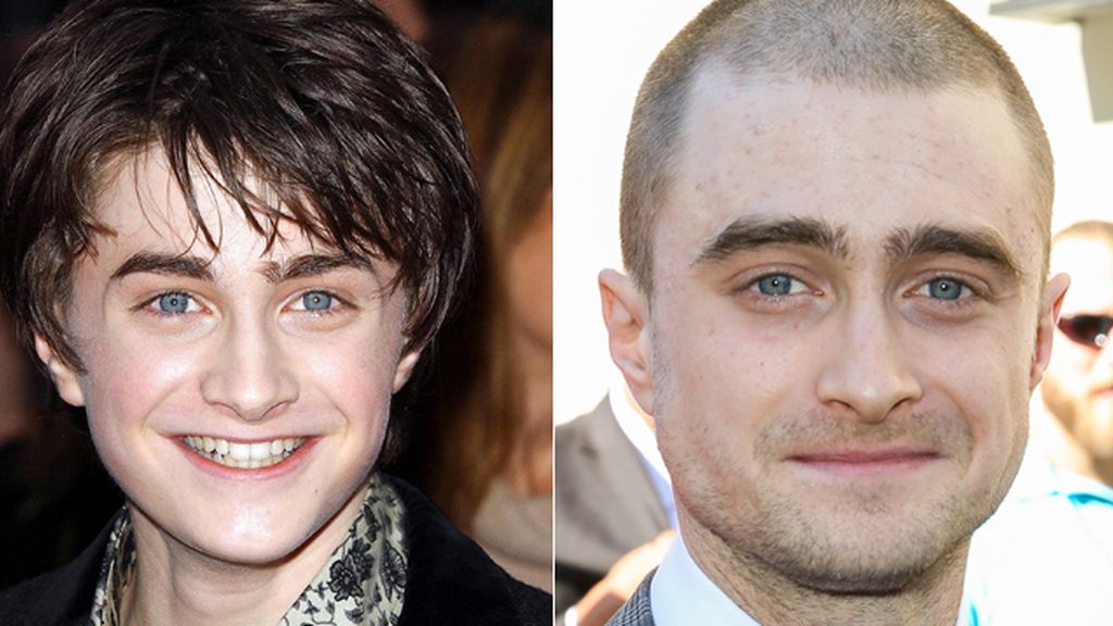Daniel Radcliffe y lo que queda de Harry Potter