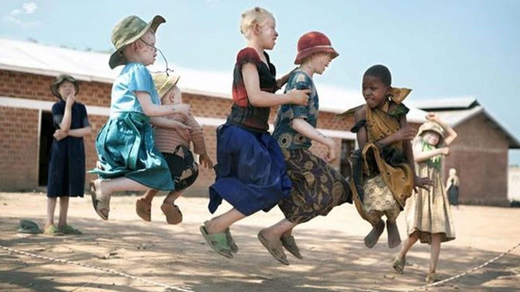 Albinos en Tanzania