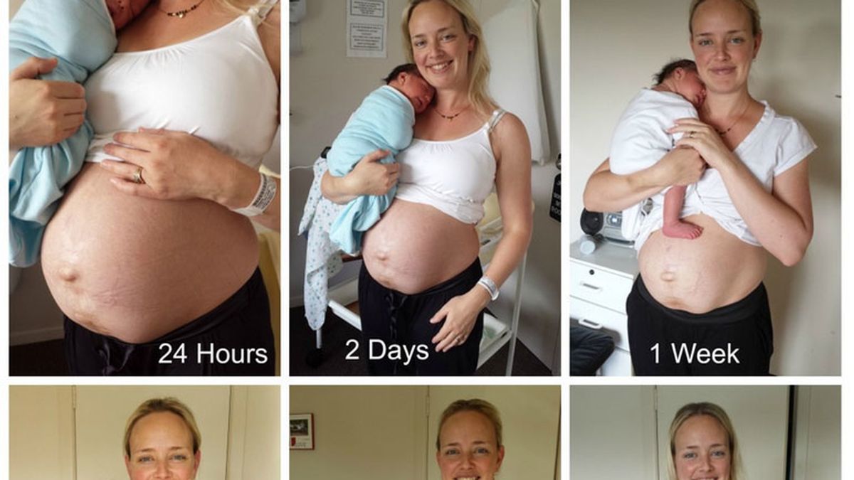 1-cómo queda realmente el cuerpo de una mujer después de dar a luz