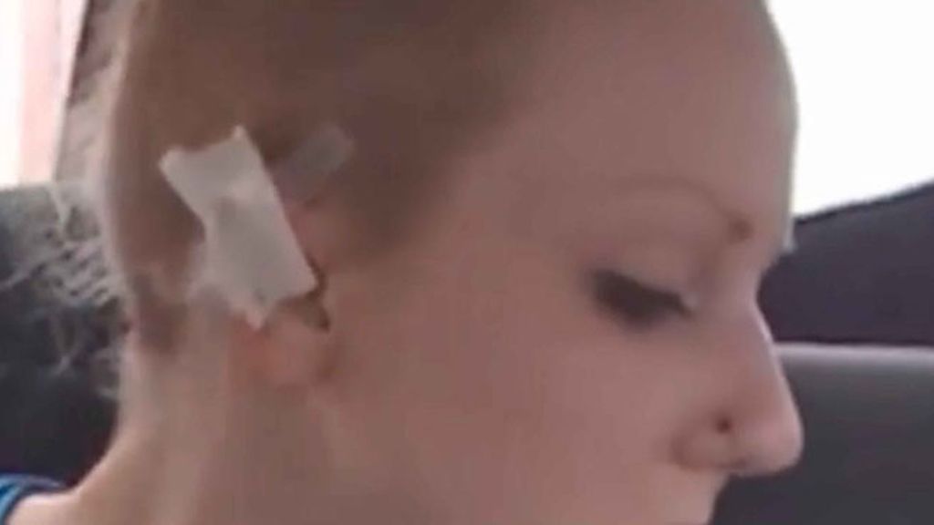 Se corta las orejas para parecer una Elfa