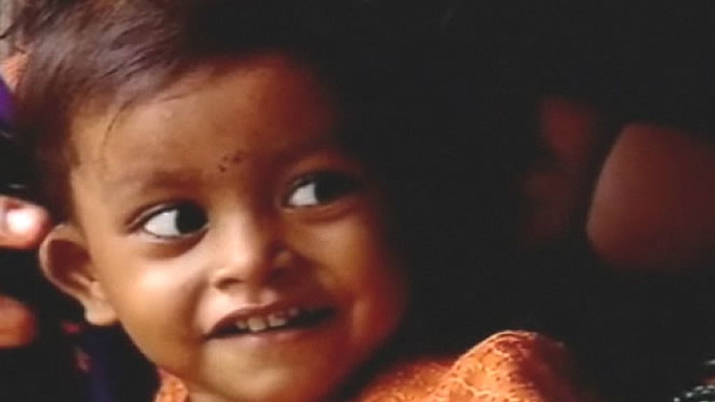 Lakshmi tiene un problema: nació con ocho extremidades