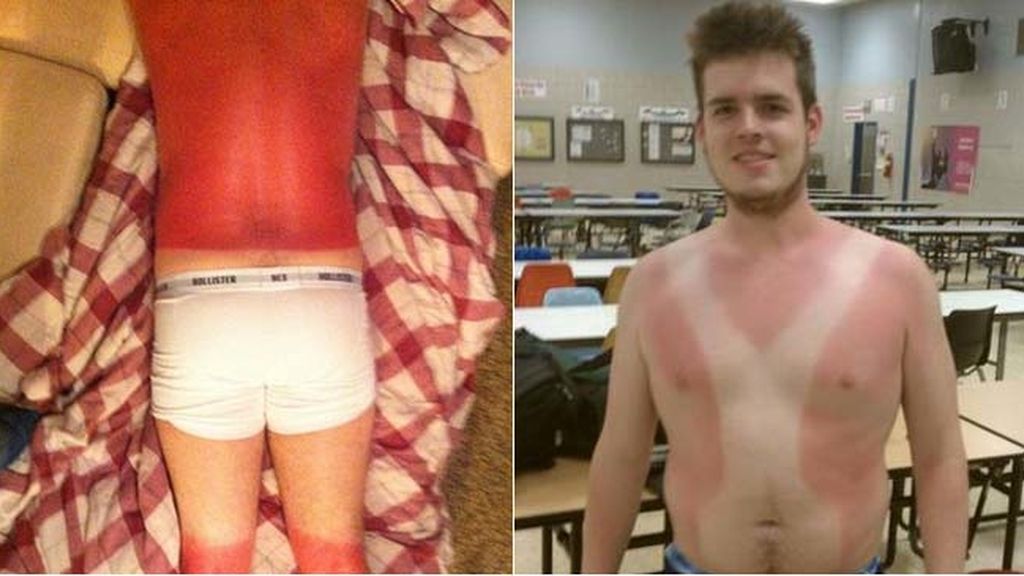 Cuando el sol te marca