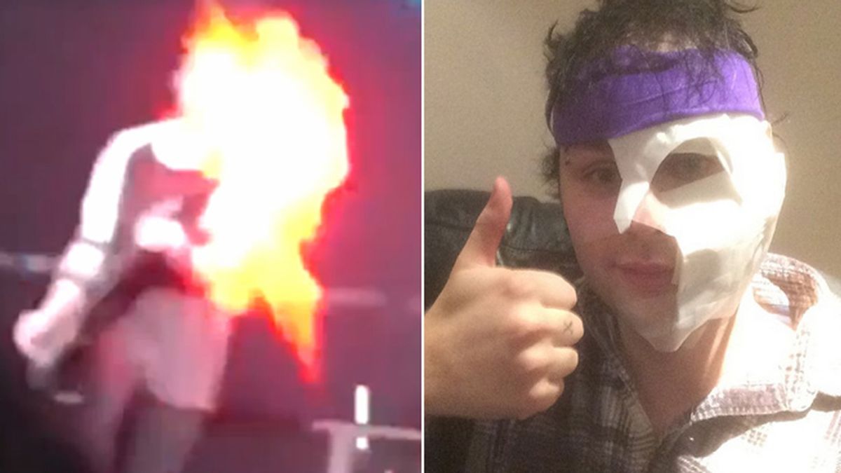 Arde el pelo del músico de 5SOS Michael Clifford