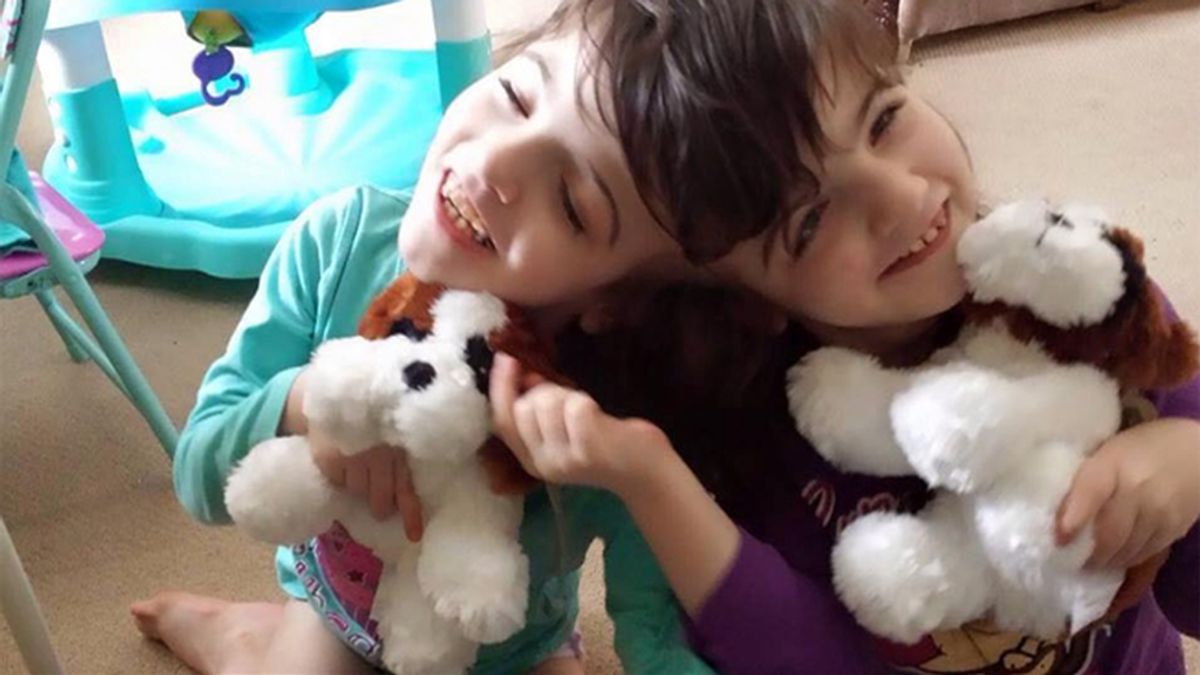 Dos gemelas siamesas de 7 años pueden ver la una a través de los ojos de la otra