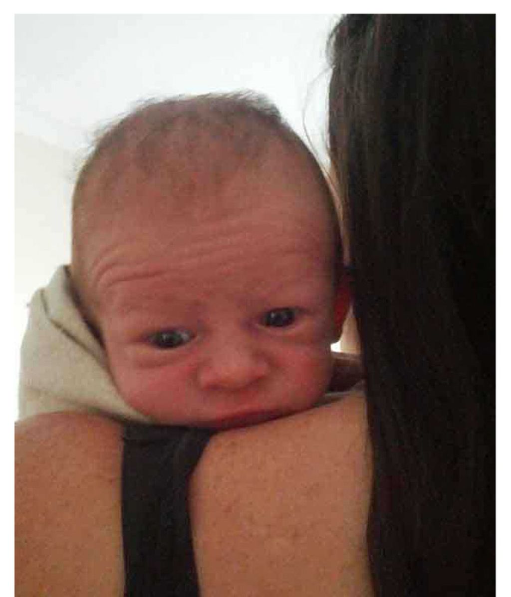 Recién nacidos con líneas de expresión