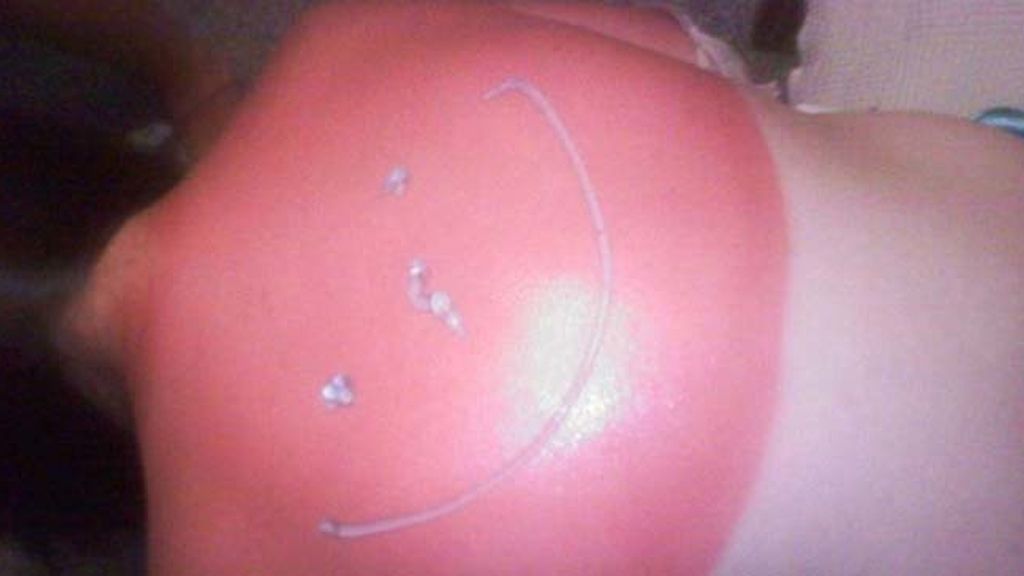 Cuando el sol te marca