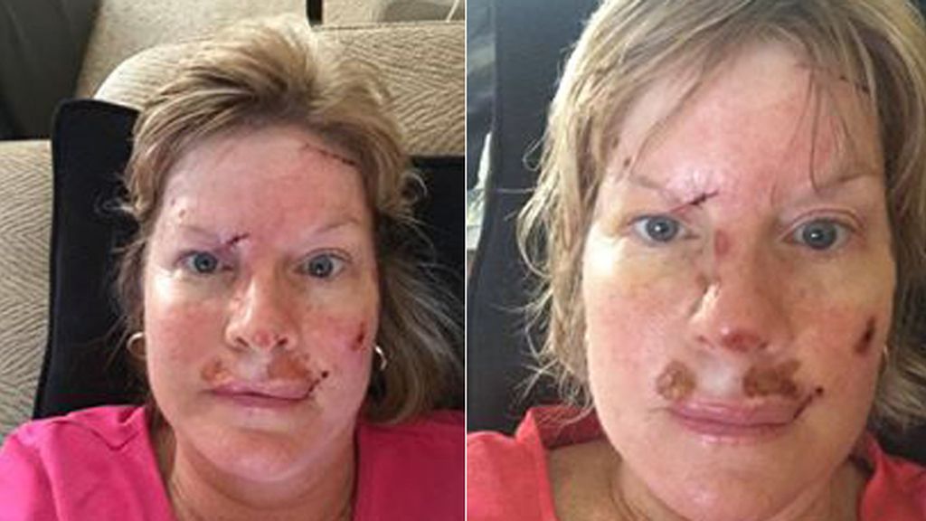 La lucha contra el cáncer de piel en imágenes