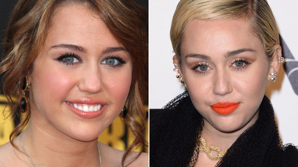 Dicen que Miley Cyrus (22) "mato" a Hannah Montana en la camilla del quirófano