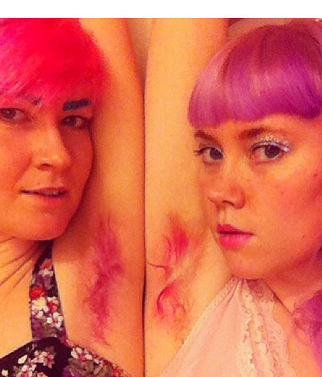 Teñirse el pelo de la axila, ¿Moda o protesta?