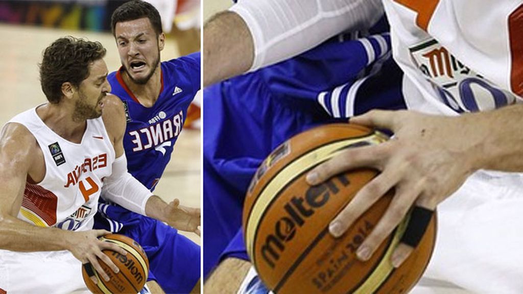 ¡Hasta los vendajes para los dedos son 'chic'!