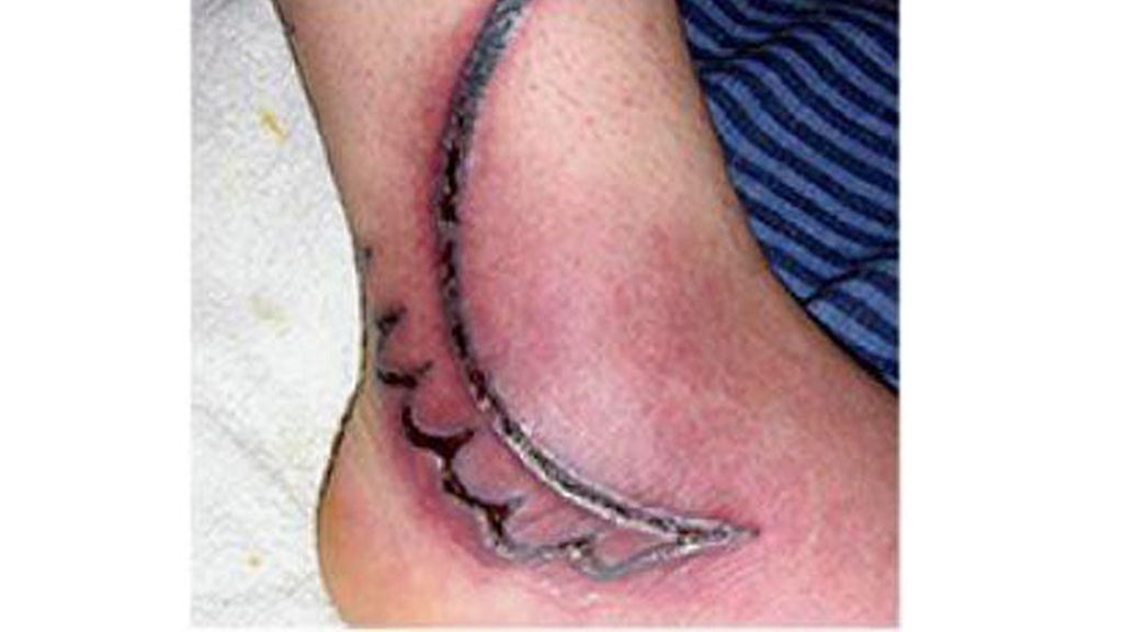 Cuando te tatúa un ‘chapucero’