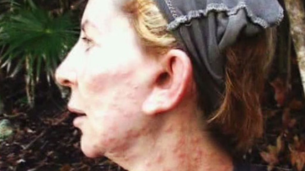 'Supervivientes 2008'