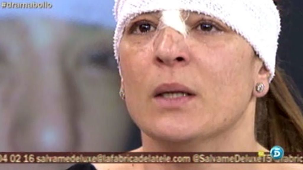 Las secuelas físicas de Raquel Bollo