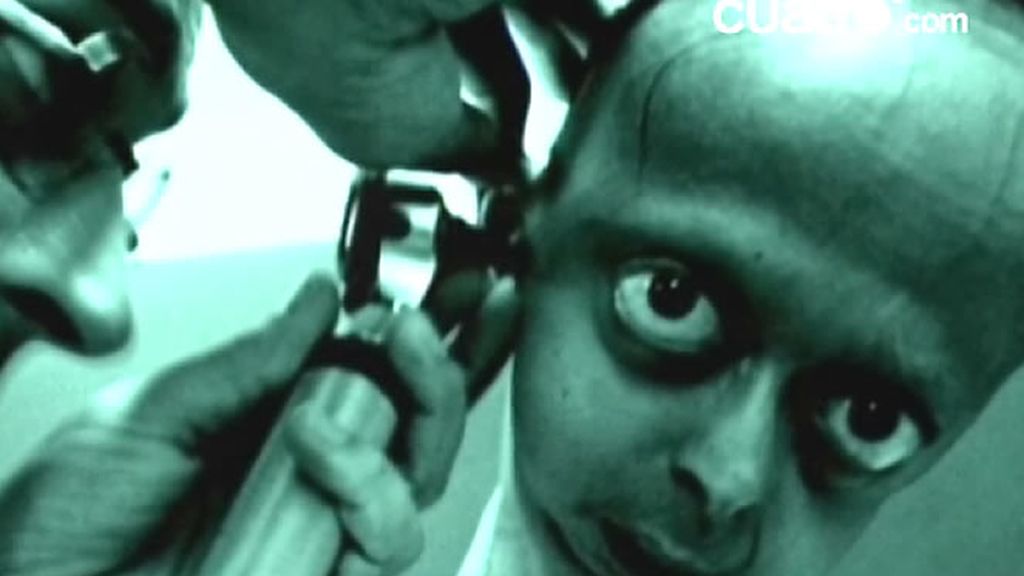 La progeria es una extrañísima enfermedad de la que sólo se conocen 42 casos en todo el mundo