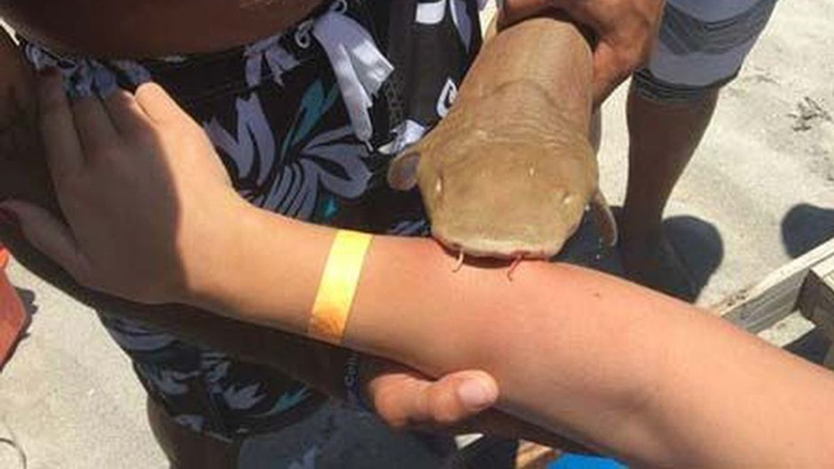 Un tiburón muerde a una joven que tuvo que ir al hospital con el escualo adosado al brazo