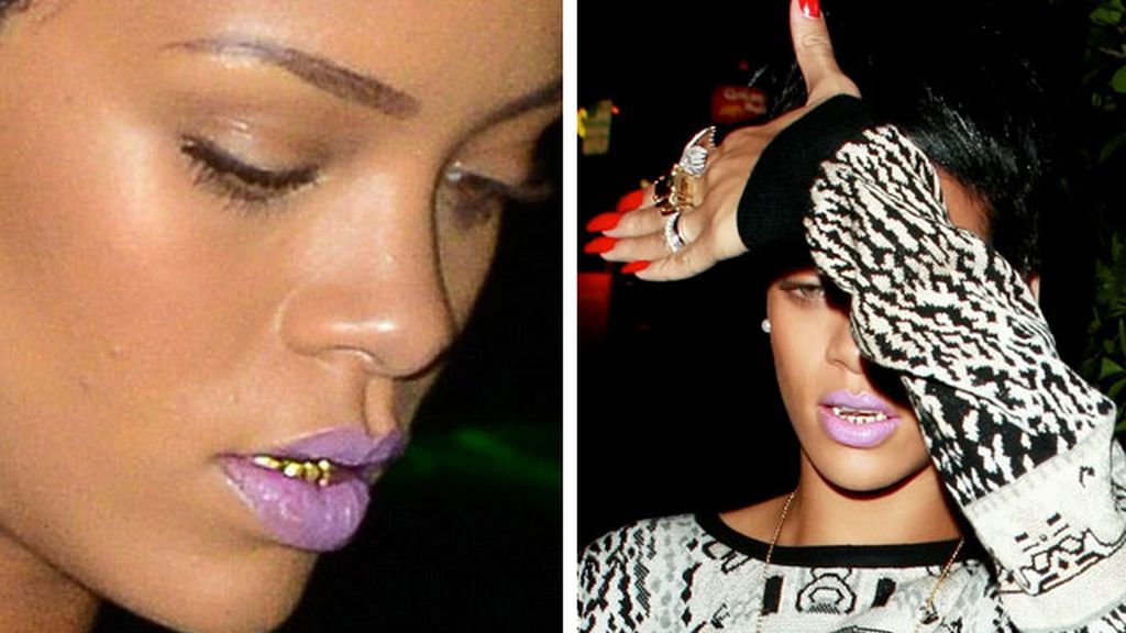 rihanna.dientes.oro1