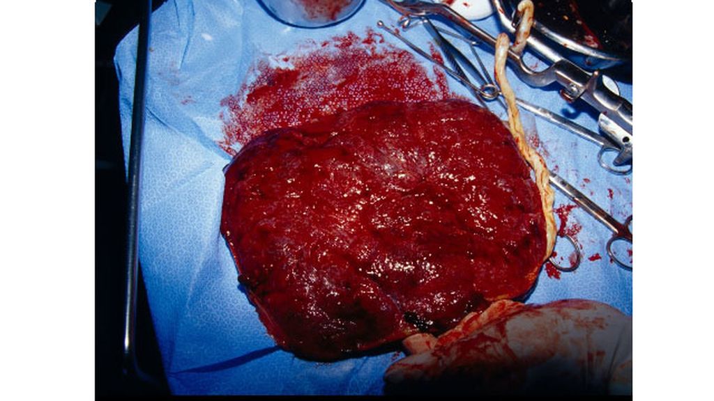 Crema a base de placenta humana