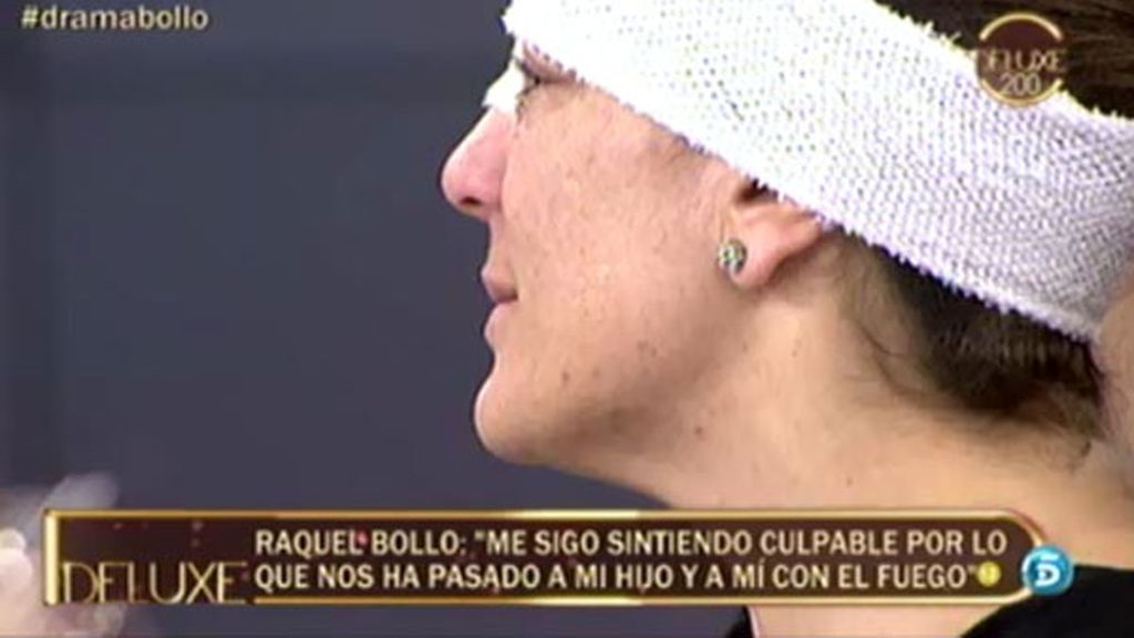 Las secuelas físicas de Raquel Bollo