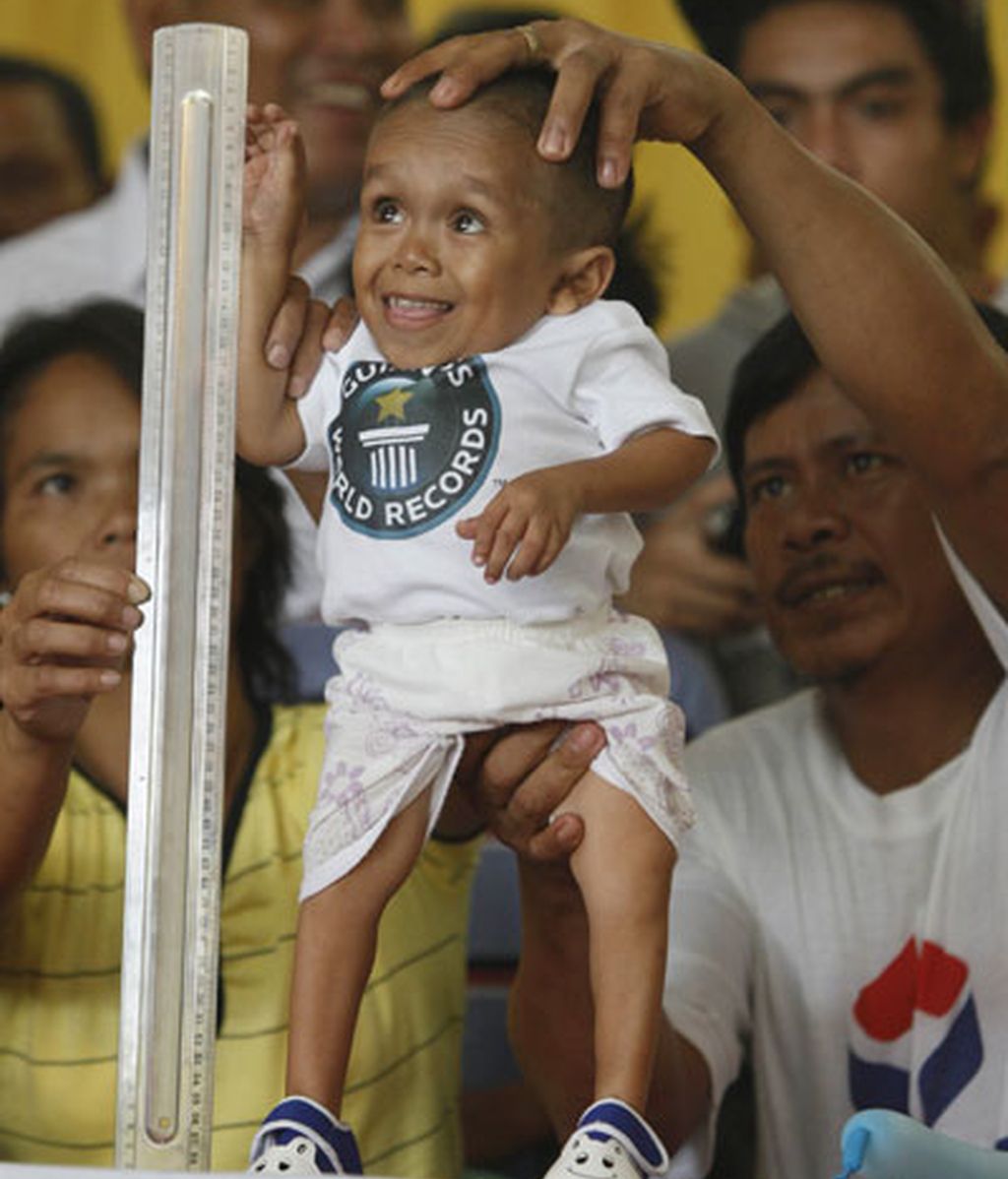 El hombre más pequeño del mundo