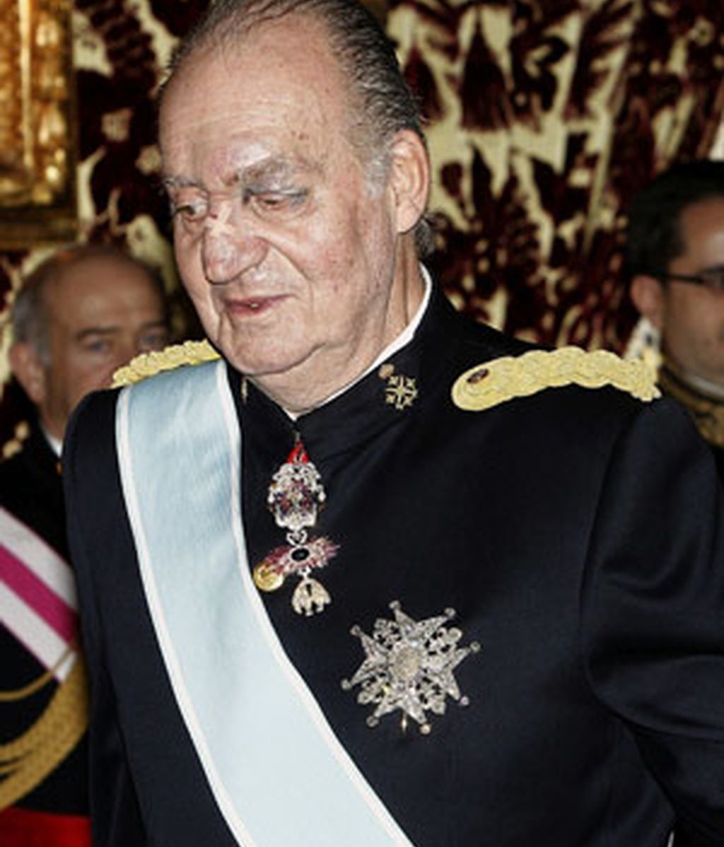 Accidente doméstico en 2011